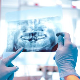 X-ray image.